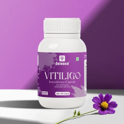 zolence vitiligo creama
