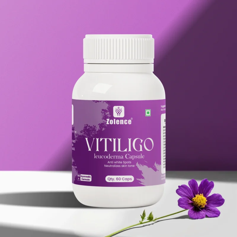 zolence vitiligo creama