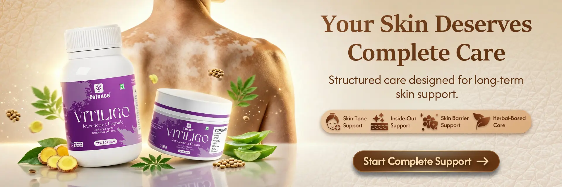 Vitiligo banner